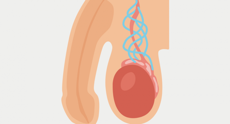 Varicocele: sintomi, rischi, quando è necessario l’intervento e perché oggi è diventato un problema rilevante tra i giovani