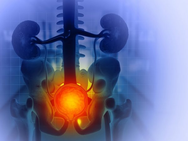 Sintomi dell’ipertrofia prostatica benigna (IPB): quando consultare un urologo